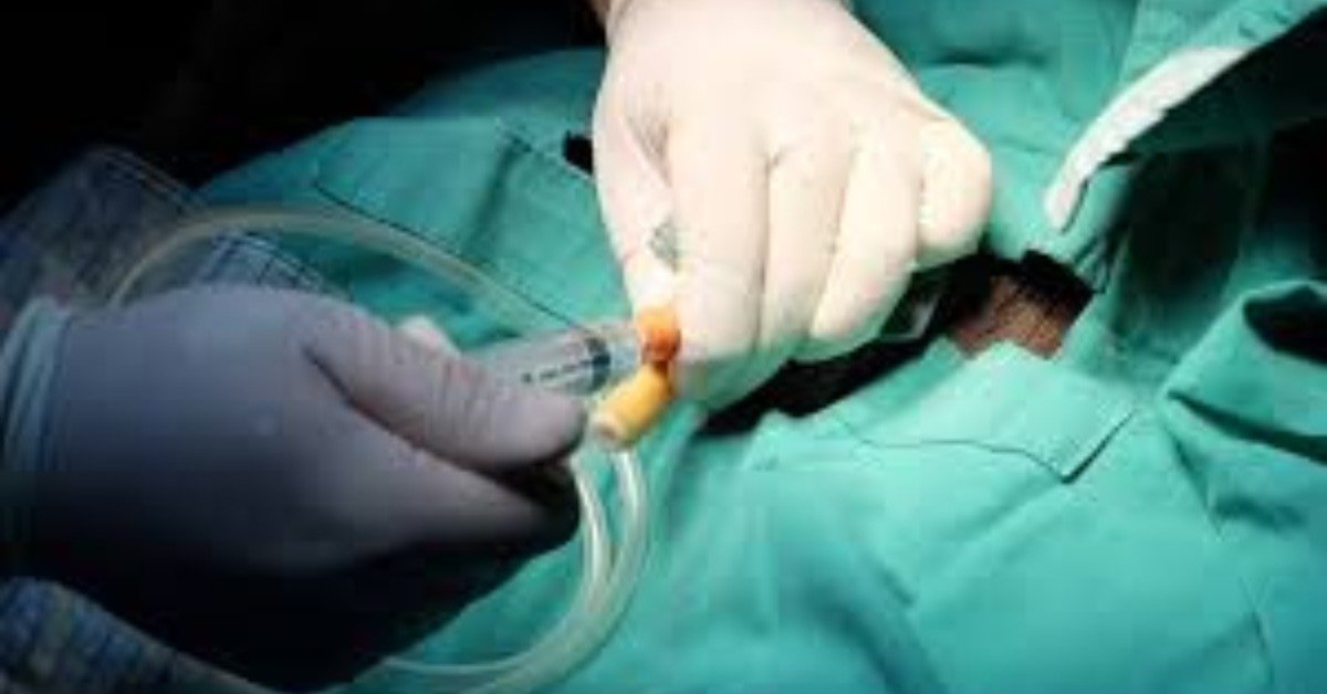 Tratamento para Próstata